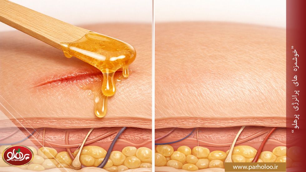 ترمیم زخمها و سلامت بافتها با مصرف عسل در بارداری | پرهلو تأثیر عسل بر ترمیم زخمها و سلامت بافتهای بدن در دوران بارداری